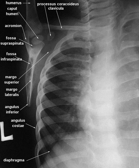 anatomia radiologiczna - 3.jpg