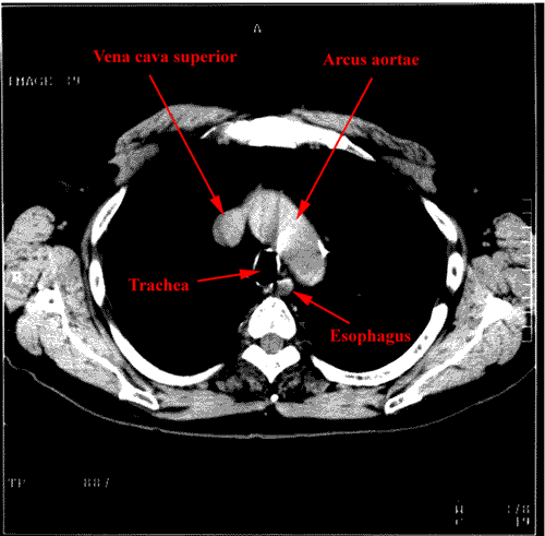 anatomia radiologiczna - 61.gif